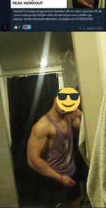 Kol mutasyonu. Kol ölçüsü 45 cm'den 49 cm'ye arttı.